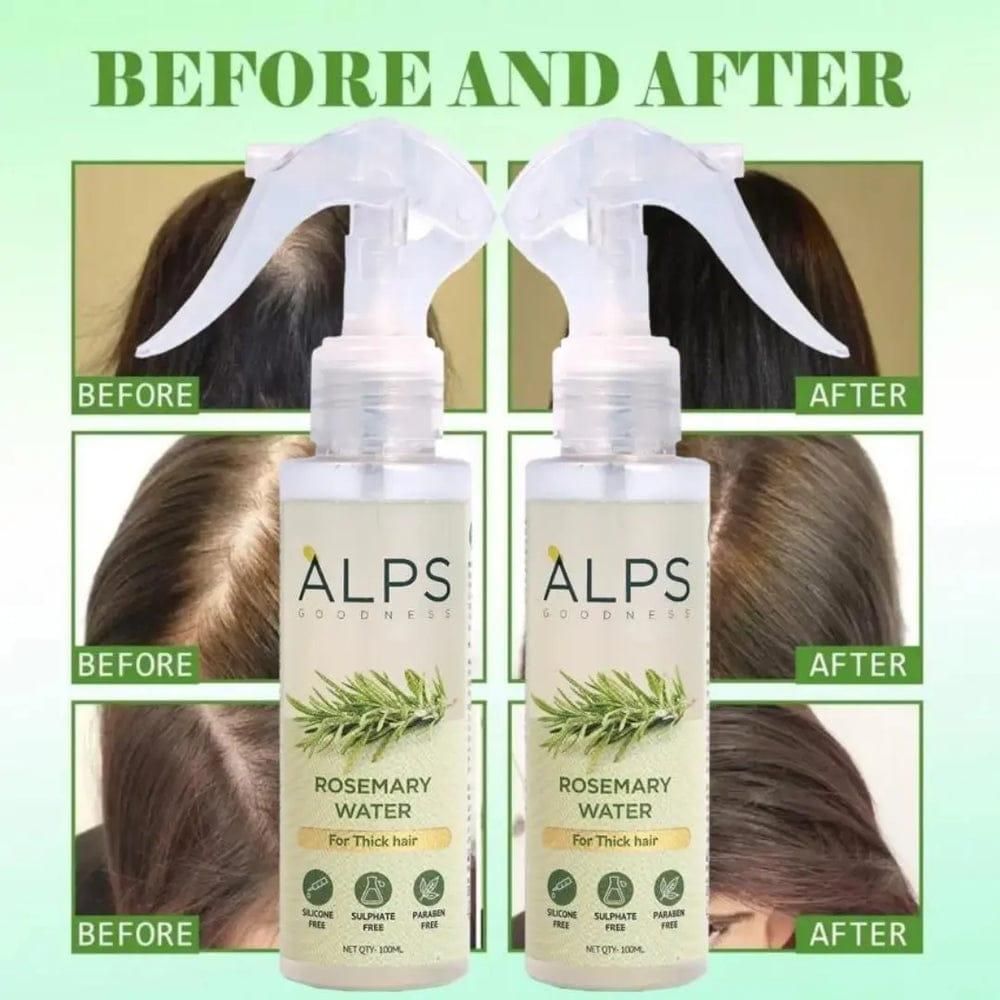 Rosemary Water, Hair Spray For Regrowth Buy 1 Get 2 Free - DEZZIRE